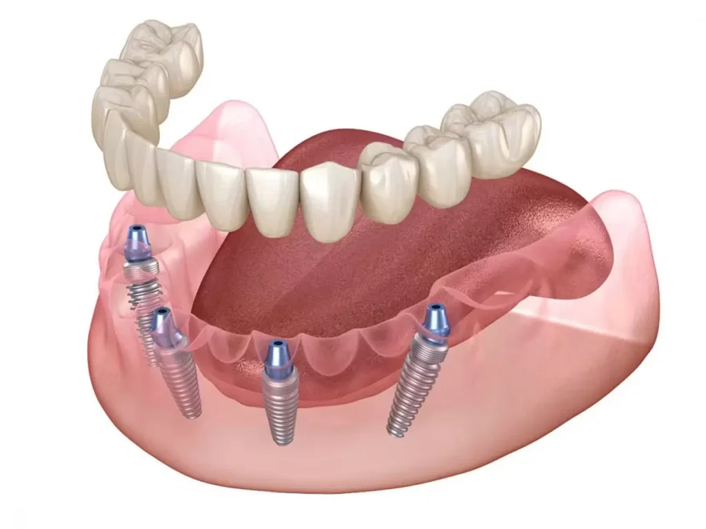 NJ Dental Space - Dental clinic near me