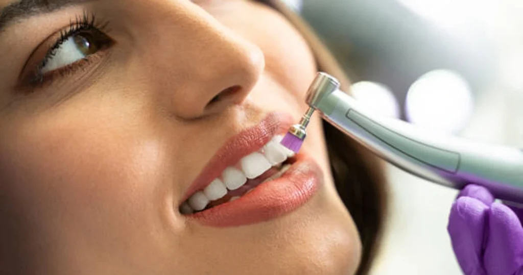 Dental Scaling and polishing treatment cost