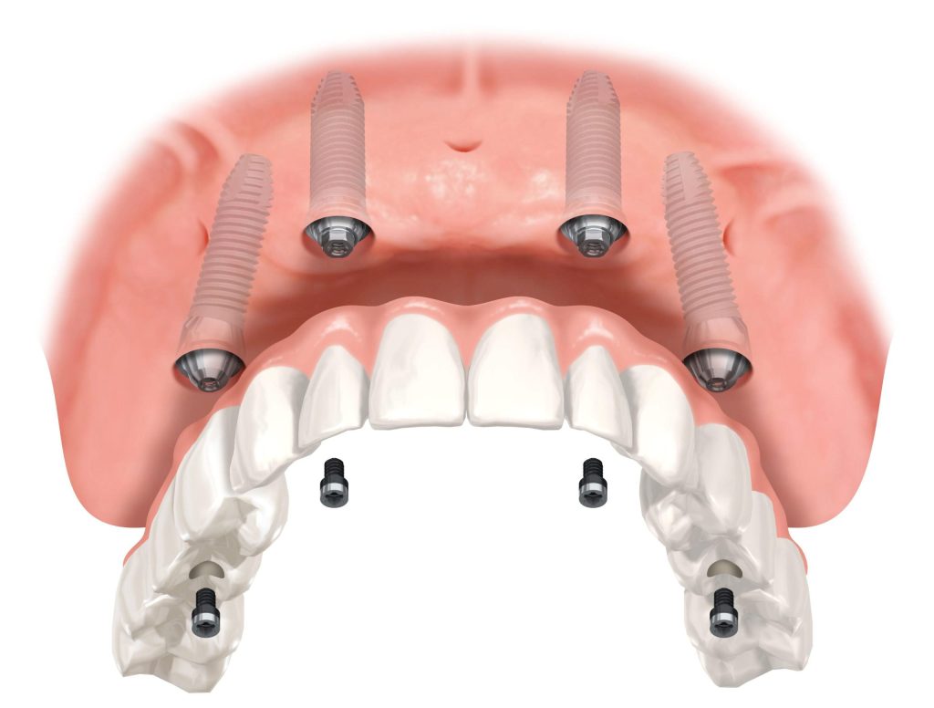 Dental clinic in saibaba colony