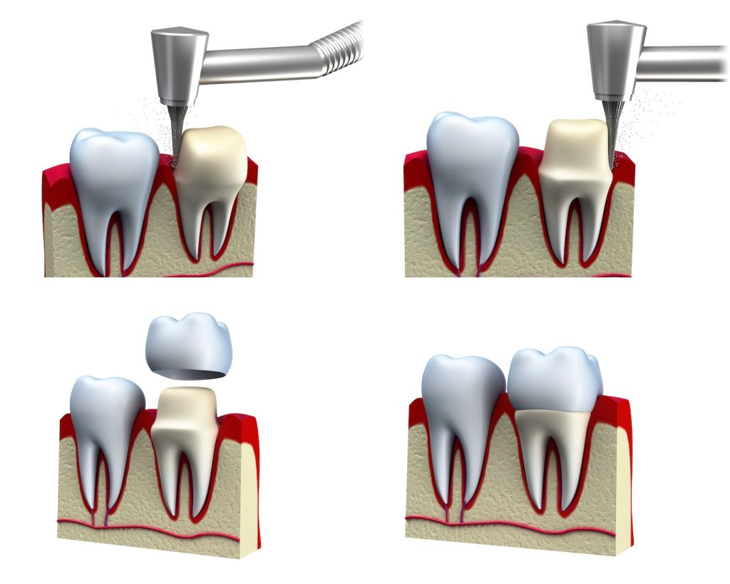 Dental clinic near me - NJ Dental Space