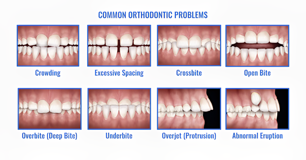 Best Orthodontic Dental Clinic in Coimbatore